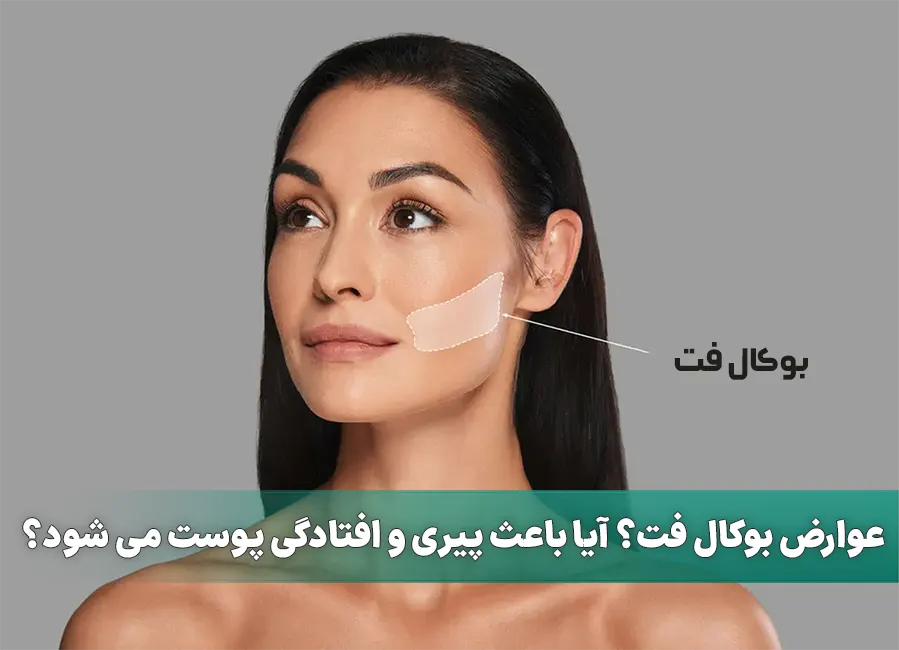 عوارض بوکال فت