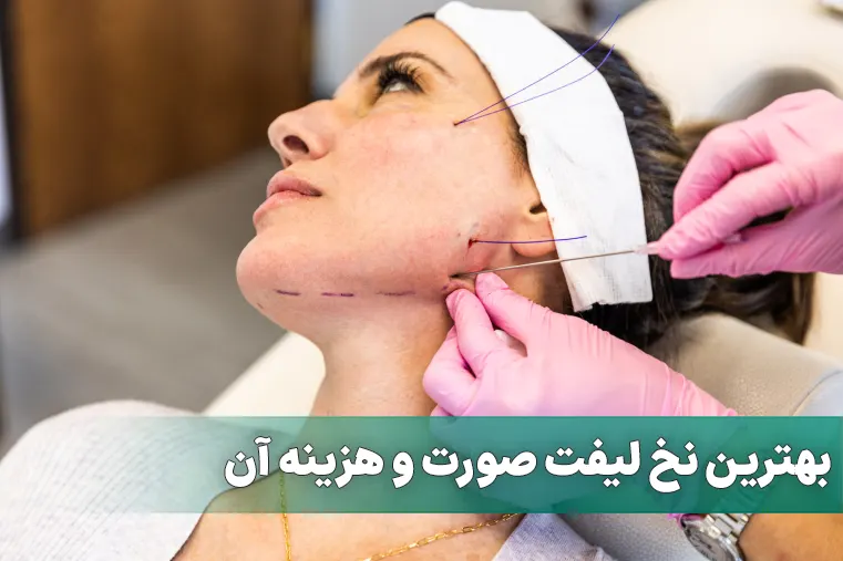 بهترین نخ لیفت صورت و هزینه آن