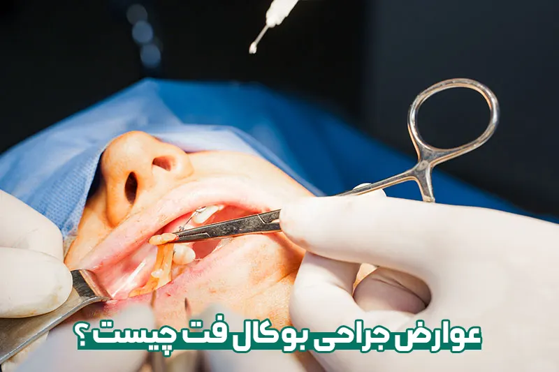 عوارض بوکال فت