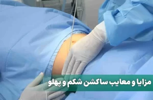 ساکشن شکم و پهلو