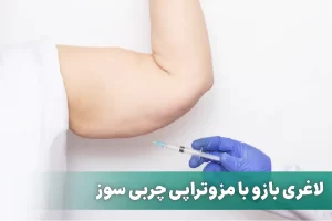 مزو چربی سوز بازو