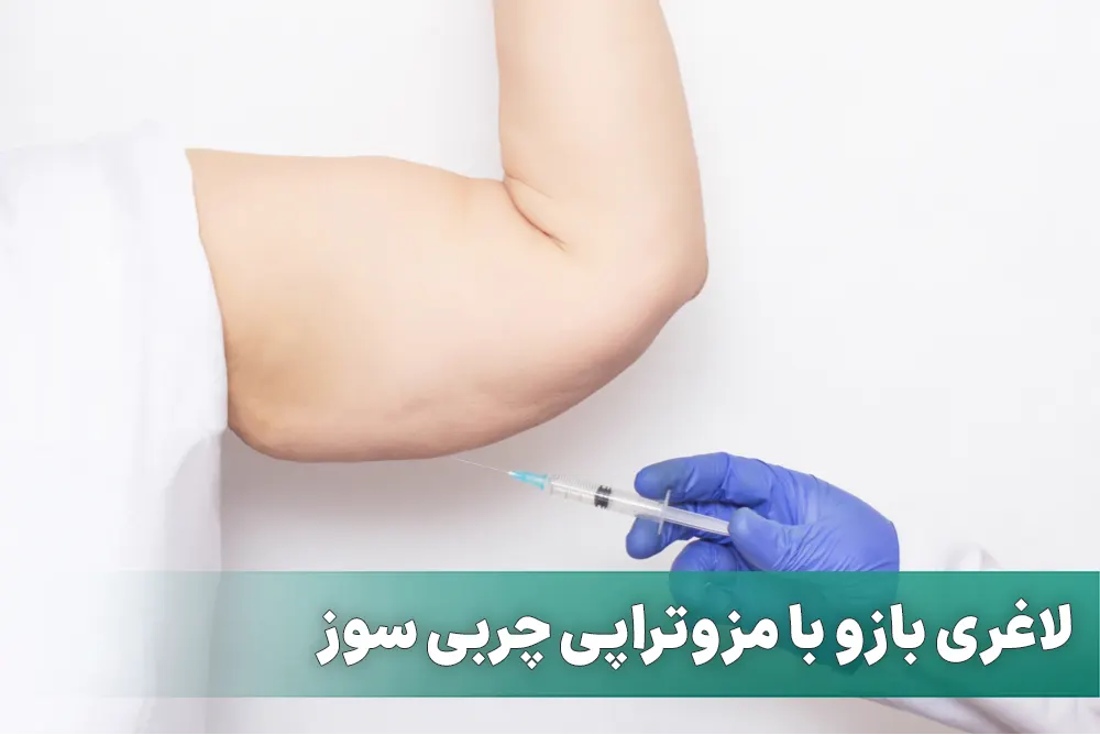 مزو چربی سوز بازو