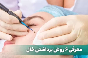 معرفی 6 روش برداشتن خال