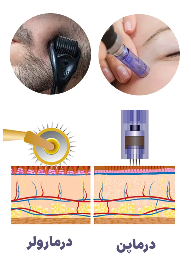 درماپن یا درمارولر