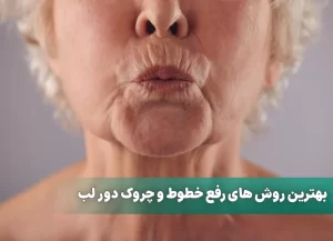 بهترین روش های رفع خطوط و چروک دور لب