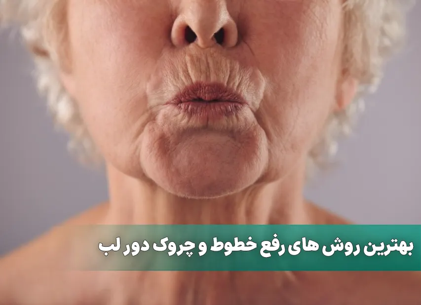 بهترین روش های رفع خطوط و چروک دور لب