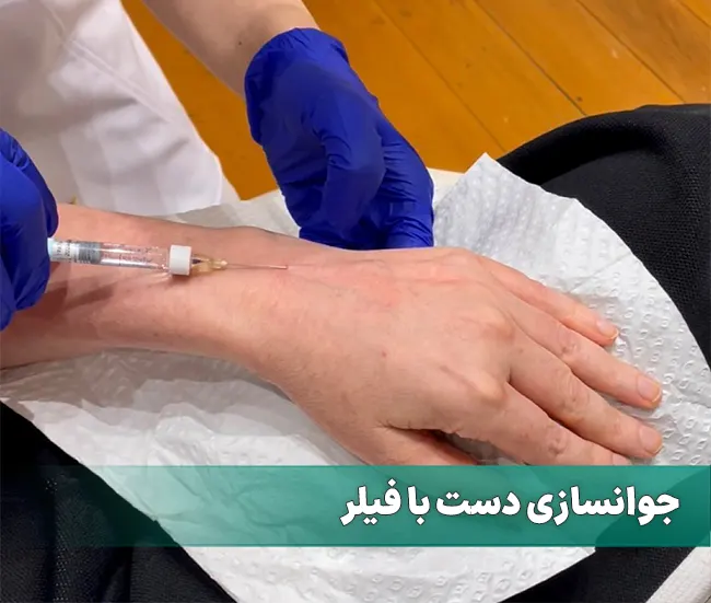 جوانسازی دست با فیلر