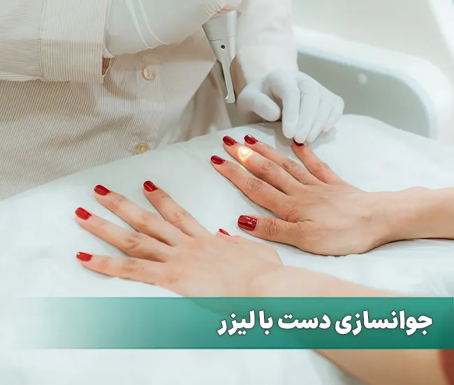 جوانسازی دست با لیزر