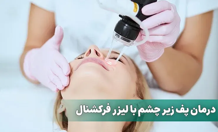 درمان پف زیر چشم با لیزر فرکشنال