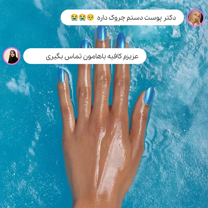 جوانسازی دست در ایوا