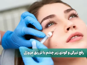 مزوژل زیر چشم
