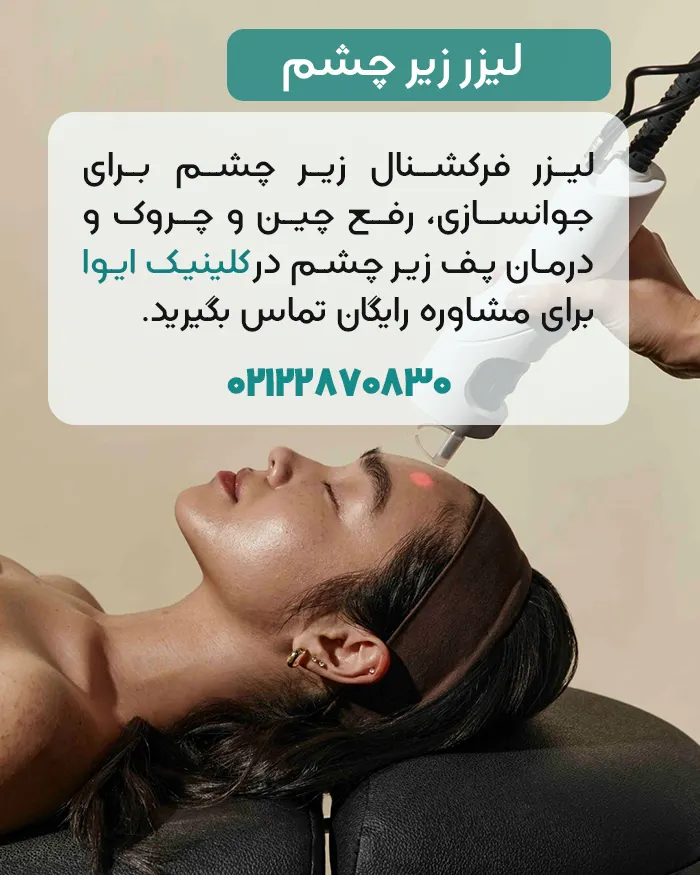 لیزر فرکشنال زیر چشم در ایوا