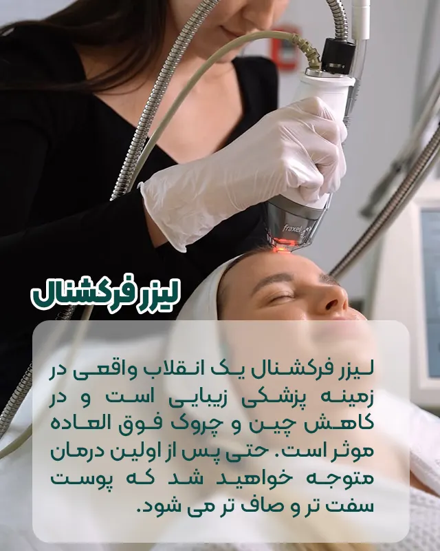 لیزر فرکشنال پیشانی