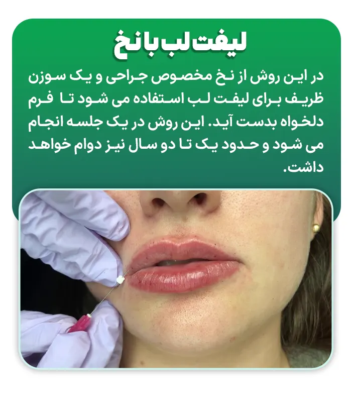 لیفت لب با نخ