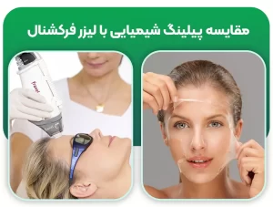 مقایسه پیلینگ شیمیایی با لیزر فرکشنال در جوانسازی پوست