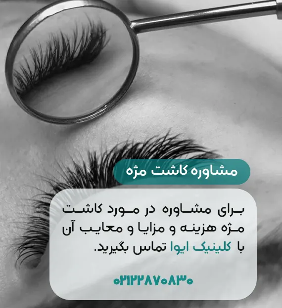کاشت مژه در ایوا