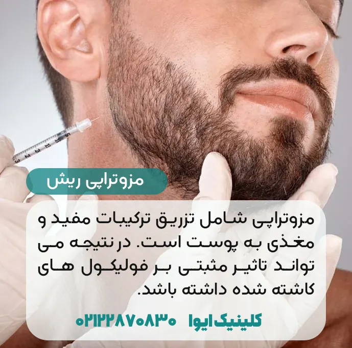 مزوتراپی ریش