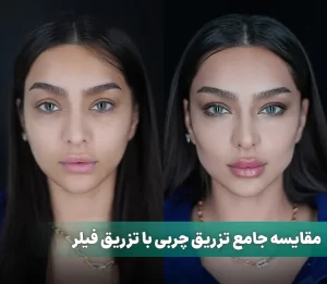 مقایسه جامع تزریق چربی با تزریق فیلر