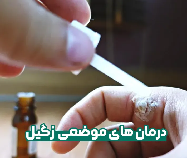 درمان های موضعی زگیل