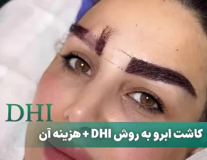 کاشت ابرو به روش DHI