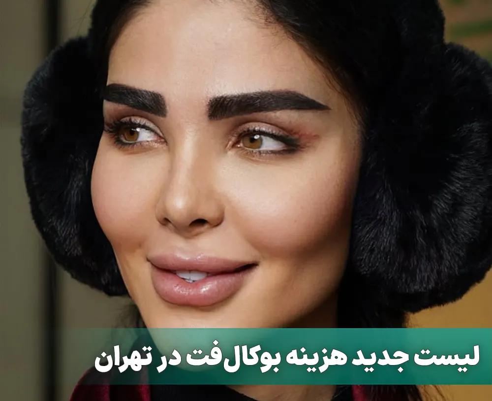 هزینه بوکال فت در تهران