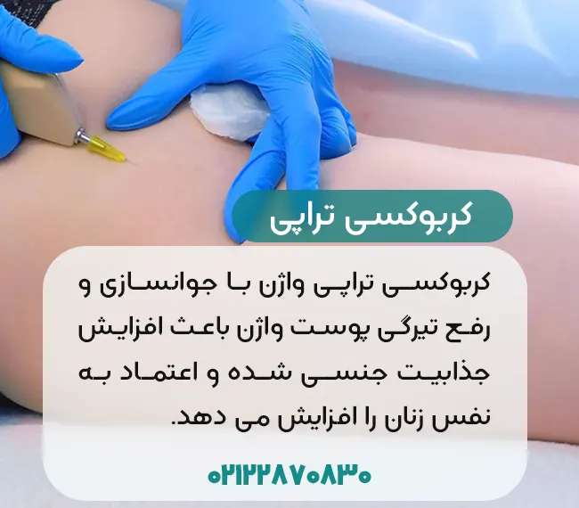 کربوکسی تراپی