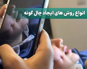 انواع روش های ایجاد چال گونه