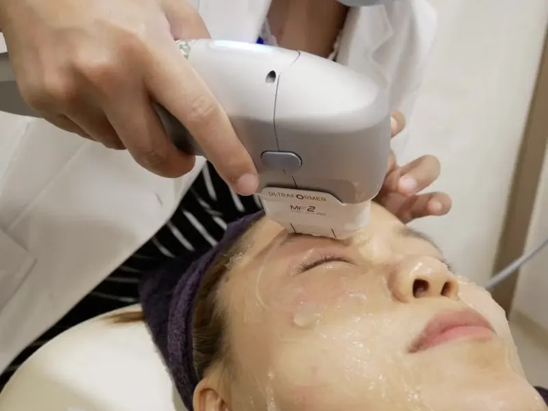 درمان افتادگی پلک با هایفو