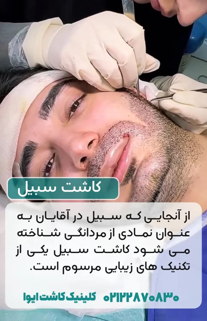کاشت سبیل