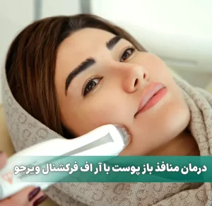 درمان منافذ باز پوست با آر اف فرکشنال ویرچو