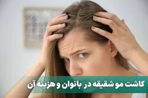 کاشت مو شقیقه در خانم ها
