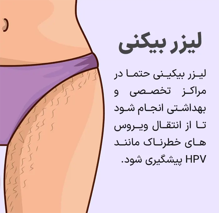 لیزر بیکینی