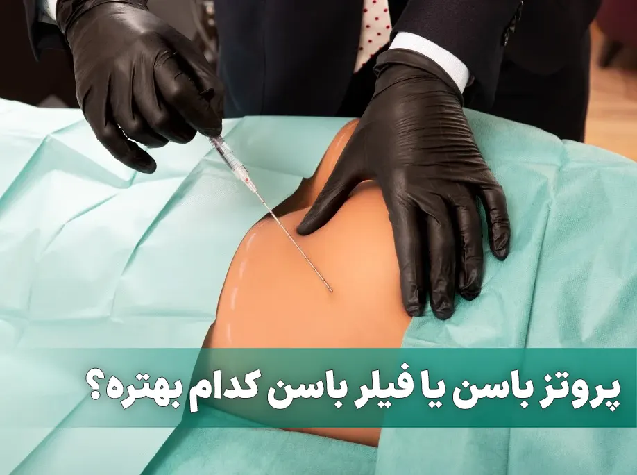 پروتز باسن یا فیلر باسن کدام بهتره؟