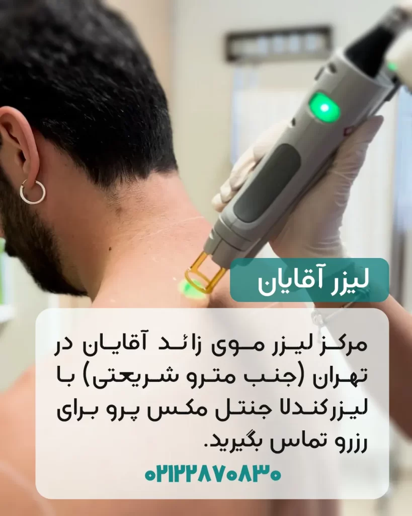 مرکز لیزر موی زائد ایوا برای آقایان