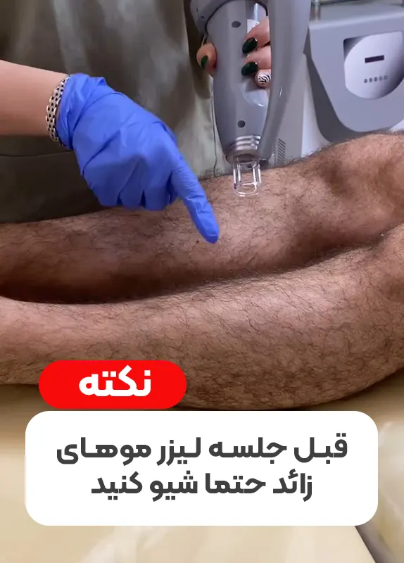 شیو قبل لیزر