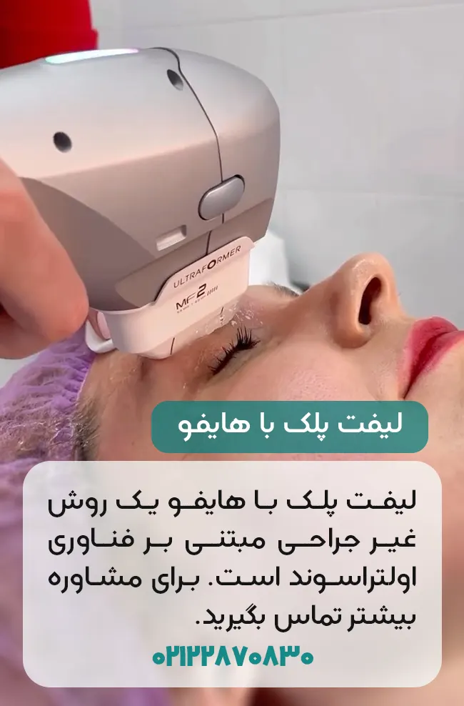 لیفت پلک با هایفو