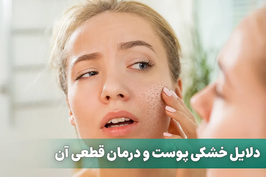 خشکی پوست و درمان آن