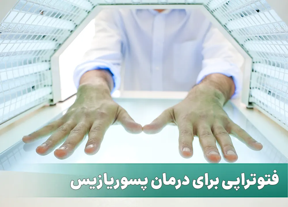 فتوتراپی پسوریازیس