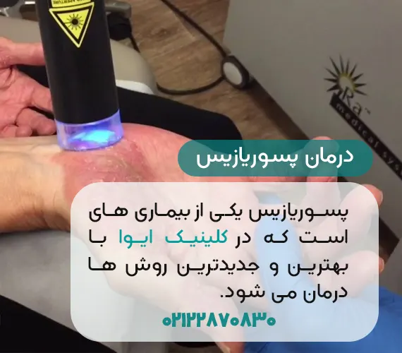 درمان پسوریازیس در کلینیک ایوا