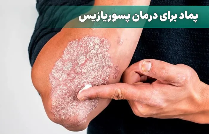 پماد برای درمان پسوریازیس