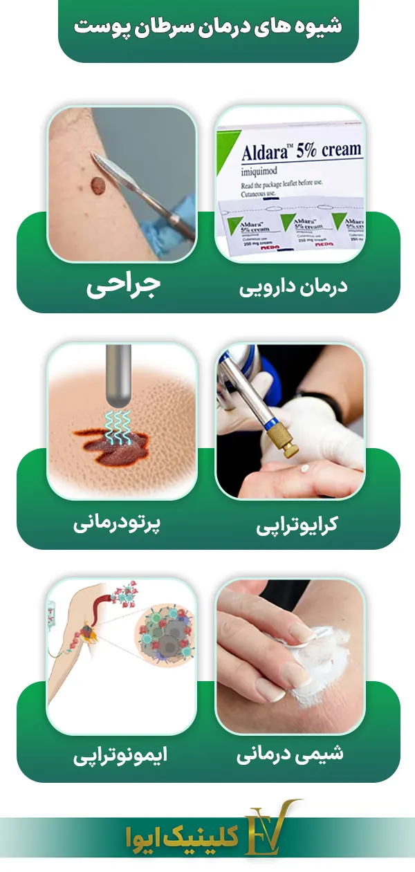 شیوه های درمان سرطان پوست