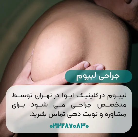 هزینه جراحی لیپوم