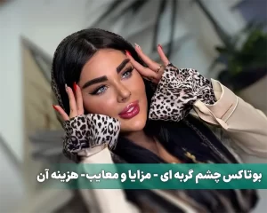 بوتاکس چشم گربه ای