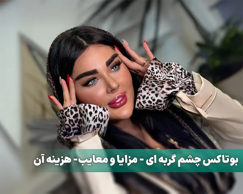 بوتاکس چشم گربه ای