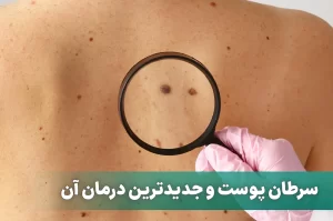 سرطان پوست و جدیدترین درمان آن