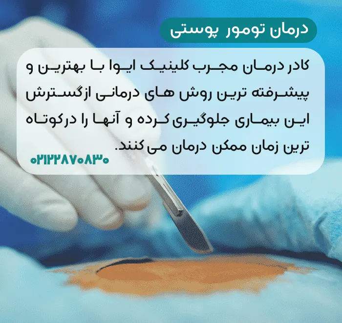 درمان تومور های پوستی