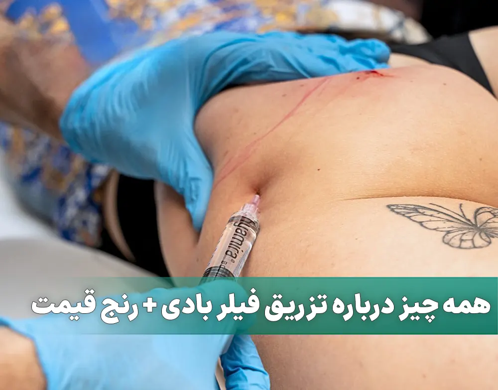 تزریق فیلر بادی