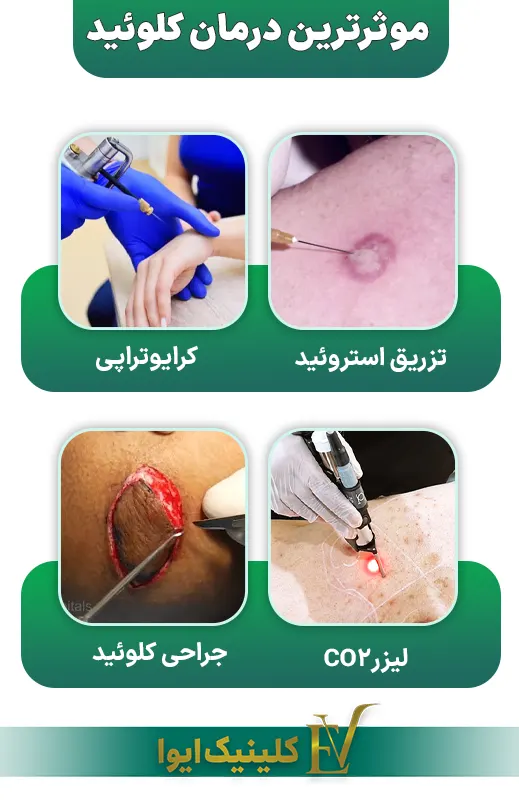 درمانی کلوئید
