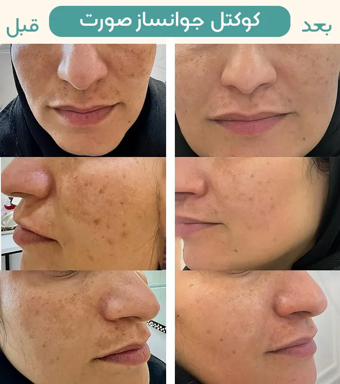 کوکتل جوانساز پوست