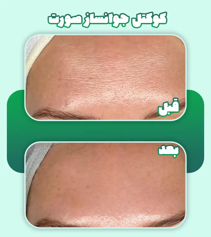 کوکتل جوانساز صورت